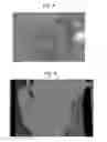 Fig. 07 - METHOD FOR PRODUCING RESIN-MOLDED BODY OF HOLLOW STRUCTURE AND A CORE USED IN IT
