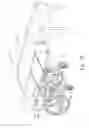 Fig. 09 - Convertible wheelchairs with movable carriages for transferring patients to/from the wheelchairs