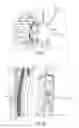 Fig. 07 - Windmill