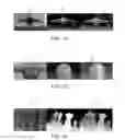 Fig. 03 - NONLINEAR DEPTH REMAPPING SYSTEM AND METHOD THEREOF