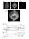 Fig. 13 - Generation method for complex amplitude in-line hologram and image recording device using said method