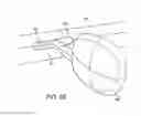 Fig. 09 - Tool for insertion and removal of in-canal hearing devices