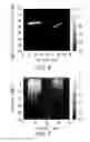 Fig. 07 - CONTRAST IMPROVEMENT METHOD AND SYSTEM FOR PHOTOACOUSTIC IMAGING