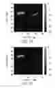 Fig. 09 - CONTRAST IMPROVEMENT METHOD AND SYSTEM FOR PHOTOACOUSTIC IMAGING