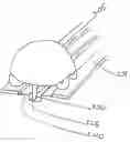 Fig. 01 - DELIVERY SYSTEM