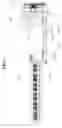 Fig. 02 - Apparatus for manufacturing vegetable gelatin capsule