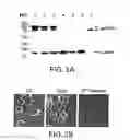 Fig. 07 - Neuronal pain pathway