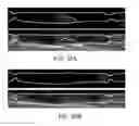 Fig. 46 - Methods of controlling magnetic nanoparticles to improve vascular flow