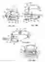 Fig. 35 - Assembly and method of implanting a heart assist system