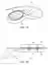 Fig. 07 - Magnetic Attachment Arrangement for Implantable Device