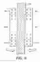 Fig. 09 - Magnetic Attachment Arrangement for Implantable Device
