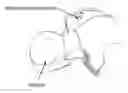 Fig. 01 - Intradural endoscope