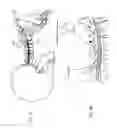 Fig. 03 - Intradural endoscope
