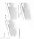 Fig. 20 - Intradural endoscope