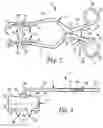 Fig. 03 - SURGICAL RETRACTOR APPARATUS AND METHOD