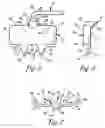 Fig. 05 - SURGICAL RETRACTOR APPARATUS AND METHOD