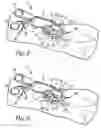 Fig. 06 - SURGICAL RETRACTOR APPARATUS AND METHOD
