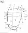 Fig. 04 - Method for assisting a person performing a minimally invasive intervention with a catheter involving a puncture of a septum and x-ray device