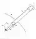 Fig. 01 - Post-biopsy cavity treatment implants and methods