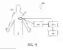Fig. 08 - Method and apparatus for determining a respiration signal