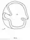 Fig. 08 - In situ molded orthotic and method for its fabrication