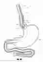 Fig. 43 - METHODS AND DEVICES FOR INTRAGASTRIC SUPPORT OF FUNCTIONAL OR PROSTHETIC GASTROINTESTINAL DEVICES