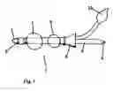 Fig. 02 - Catheter for transanal irrigation