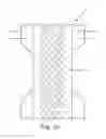 Fig. 06 - Disposable absorbent articles having an interior design signal