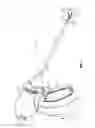 Fig. 02 - Apparatus for performing an electrosurgical procedure
