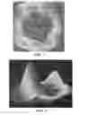 Fig. 05 - Joint arthroplasty devices and surgical tools