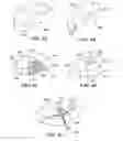Fig. 08 - Joint arthroplasty devices and surgical tools