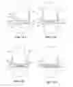Fig. 12 - Joint arthroplasty devices and surgical tools