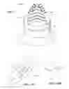 Fig. 20 - Joint arthroplasty devices and surgical tools