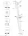 Fig. 22 - Joint arthroplasty devices and surgical tools