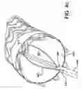 Fig. 08 - Apposition fiber for use in endoluminal deployment of expandable devices in tortuous anatomies