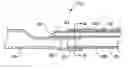 Fig. 01 - BALLOON CATHETER WITH IMPROVED PUSHABILITY