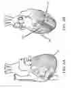Fig. 07 - Devices and methods for controlling blood perfusion pressure