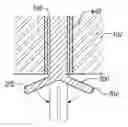 Fig. 01 - Collapsible plug for tissue closure