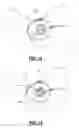 Fig. 08 - Methods and Apparatus for Treating Spinal Stenosis