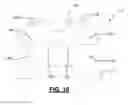 Fig. 09 - Methods and Apparatus for Treating Spinal Stenosis