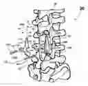Fig. 01 - Adjustable spine distraction implant