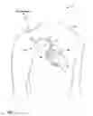 Fig. 02 - Phrenic nerve stimulation detection using heart sounds