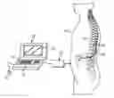 Fig. 01 - System and method for programming neurostimulation devices using cached plug-in software drivers