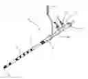 Fig. 01 - Intracerebral electrode