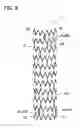 Fig. 07 - Stent delivery system