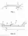 Fig. 02 - Side branched endoluminal prostheses and methods of delivery thereof
