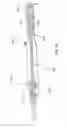 Fig. 22 - Methods of implanting a prosthesis