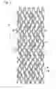 Fig. 02 - BIOABSORBABLE STENT