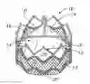 Fig. 01 - Encapsulated heart valve