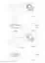Fig. 08 - ACCOMODATING INTRAOCULAR LENS